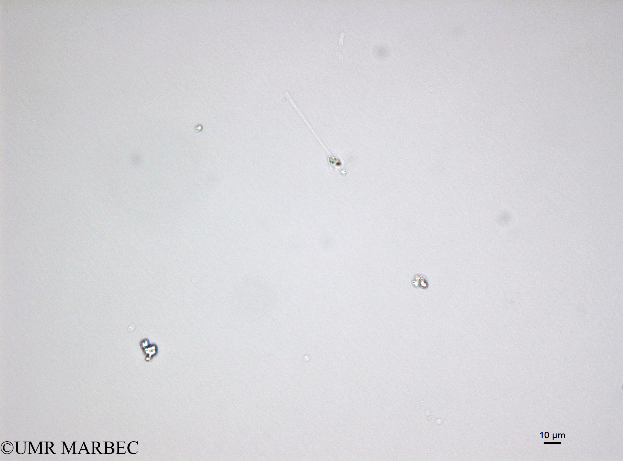 phyto/Bizerte/bizerte_bay/RISCO November 2015/Asterionellopsis glacialis (150417_001_ovl-3).tif(copy).jpg